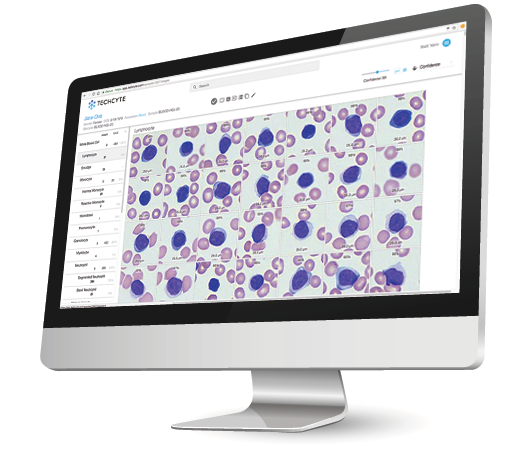 techcyte-on-monitor
