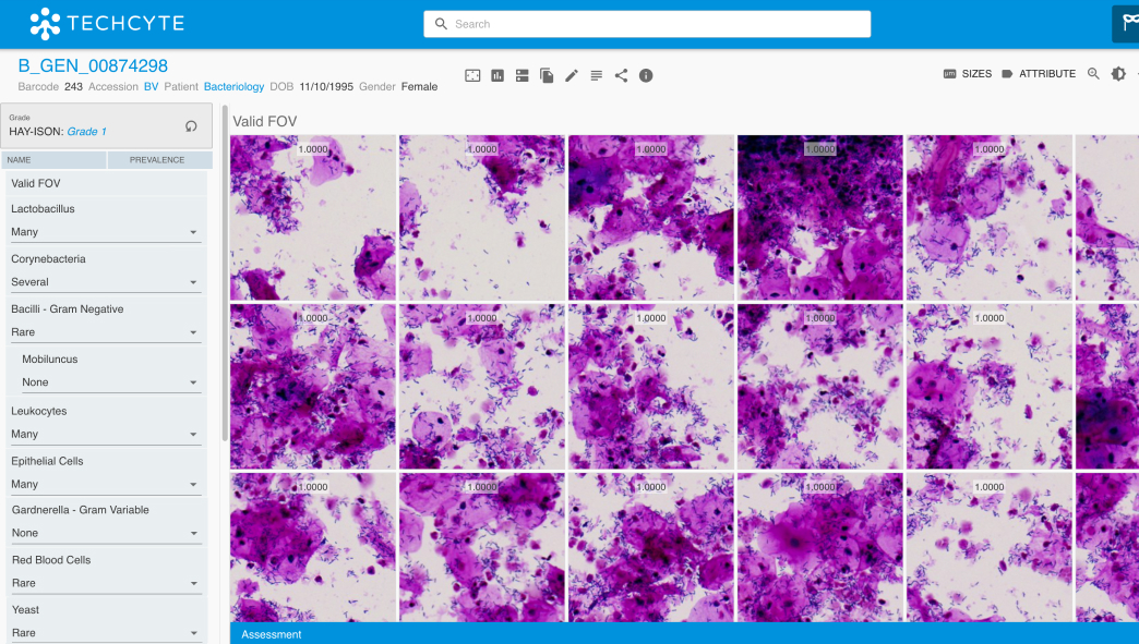 Bacteriology BV Gram Stain Classifier | Techcyte