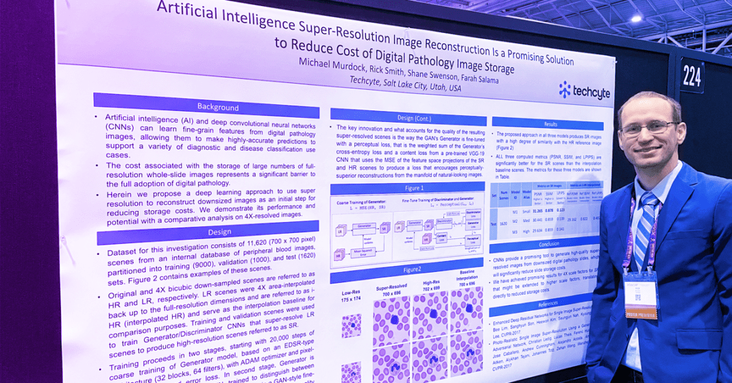 Poster Presentation Of AI SuperResolution Image Reconstruction At