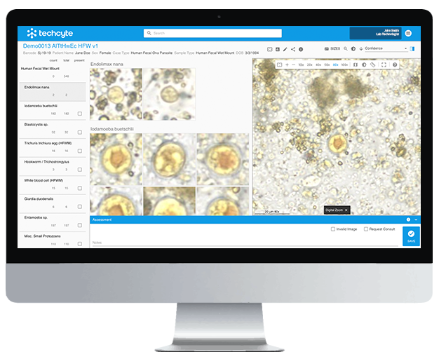 Why AI, Not Molecular Diagnostics, is the Future of Parasitology 1 HFW monitor