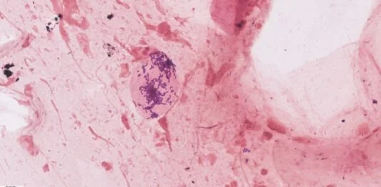 Fusion Bacteriology Suite