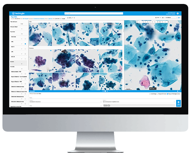 ai-based digital cervical cytology system from Techcyte