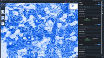 Fusion AP 3 Techcyte Fusion AP FS Report View updated