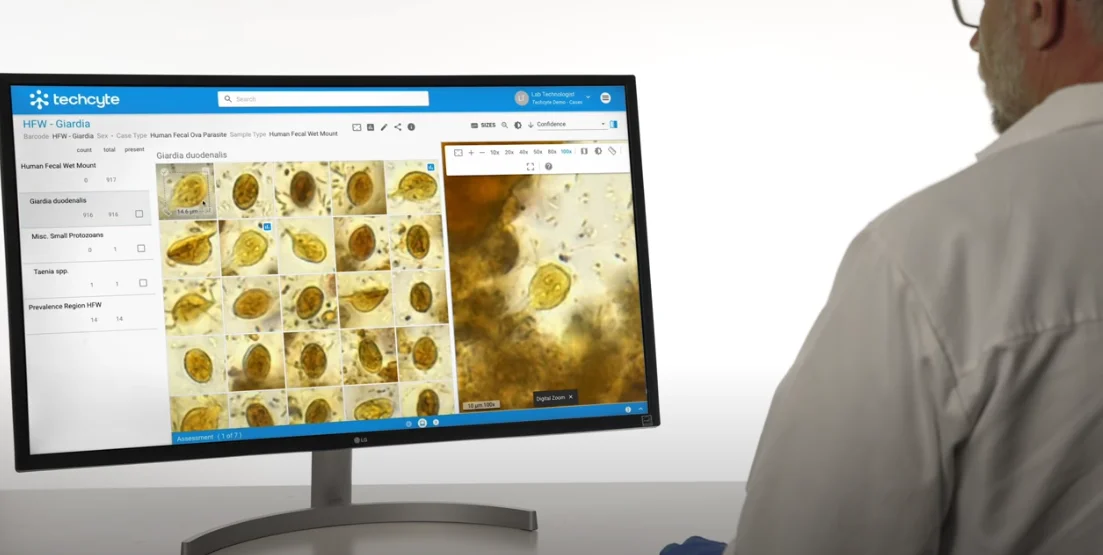 techcyte-fusion-parsitology-suite-wet-mount-solution-techcyte